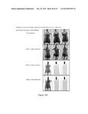 COMPOSITIONS AND METHODS FOR THE TREATMENT OF BRAIN CANCERS diagram and image