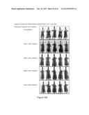 COMPOSITIONS AND METHODS FOR THE TREATMENT OF BRAIN CANCERS diagram and image