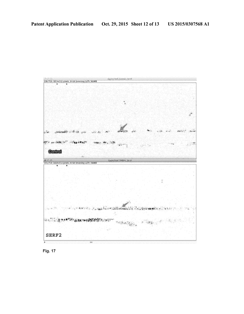 Medicament for atrophy treatment or increasing cell growth - diagram, schematic, and image 13