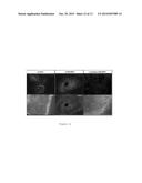 PEPTIDIC ANTAGONISTS OF CLASS III SEMAPHORINS/NEUROPILINS COMPLEXES diagram and image