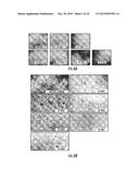 MIMETIC PEPTIDES DERIVED FROM COLLAGEN TYPE IV AND THEIR USE FOR TREATING     ANGIOGENESIS- AND LYMPHANGIOGENESIS- DEPENDENT DISEASES diagram and image