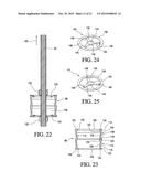 Concrete Anchor diagram and image