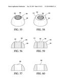 Concrete Anchor diagram and image