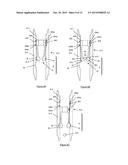 Downhole Apparatus and Method diagram and image