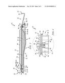 FAN CONTAINMENT CASE diagram and image