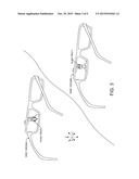 FACIAL EXPRESSION TRACKING diagram and image