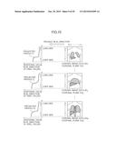 IMAGE-BASED DETECTION OF THE BOUNDARY BETWEEN A FIRST PART AND A SECOND     PART diagram and image