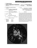 SYSTEM AND METHOD OF MEDICAL IMAGING diagram and image