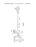 System and Method of Scanning a Body Cavity Using a Multiple Viewing     Elements Endoscope diagram and image