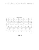 REDUCING ELECTROCARDIOGRAM ARTIFACTS DURING AND POST CPR diagram and image