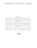REDUCING ELECTROCARDIOGRAM ARTIFACTS DURING AND POST CPR diagram and image