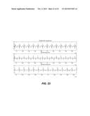 REDUCING ELECTROCARDIOGRAM ARTIFACTS DURING AND POST CPR diagram and image