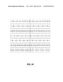 REDUCING ELECTROCARDIOGRAM ARTIFACTS DURING AND POST CPR diagram and image