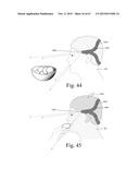 Mobile Wearable Electromagnetic Brain Activity Monitor diagram and image