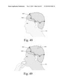 Mobile Wearable Electromagnetic Brain Activity Monitor diagram and image