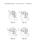 Mobile Wearable Electromagnetic Brain Activity Monitor diagram and image