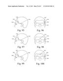 Mobile Wearable Electromagnetic Brain Activity Monitor diagram and image