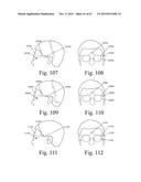 Mobile Wearable Electromagnetic Brain Activity Monitor diagram and image