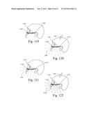 Mobile Wearable Electromagnetic Brain Activity Monitor diagram and image