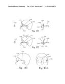 Mobile Wearable Electromagnetic Brain Activity Monitor diagram and image