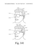 Mobile Wearable Electromagnetic Brain Activity Monitor diagram and image
