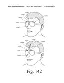 Mobile Wearable Electromagnetic Brain Activity Monitor diagram and image