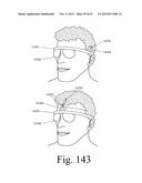 Mobile Wearable Electromagnetic Brain Activity Monitor diagram and image