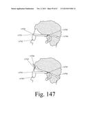 Mobile Wearable Electromagnetic Brain Activity Monitor diagram and image