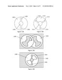 X-Ray Reduction System diagram and image