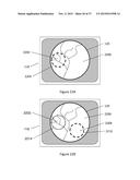 X-Ray Reduction System diagram and image