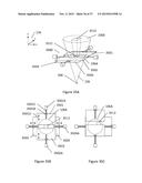 X-Ray Reduction System diagram and image