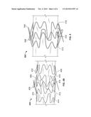 Anastomosis Devices diagram and image