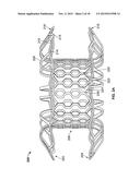 Anastomosis Devices diagram and image