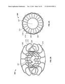 Anastomosis Devices diagram and image