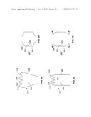 Anastomosis Devices diagram and image