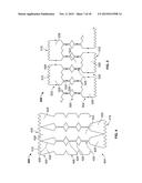 Anastomosis Devices diagram and image