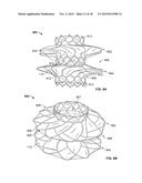 Anastomosis Devices diagram and image