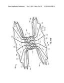 Anastomosis Devices diagram and image