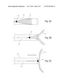 Occlusion Device diagram and image