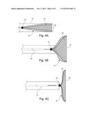 Occlusion Device diagram and image