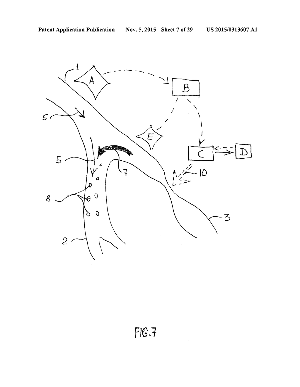 NONINVASIVE PROTECTION FROM EMBOLI - diagram, schematic, and image 08