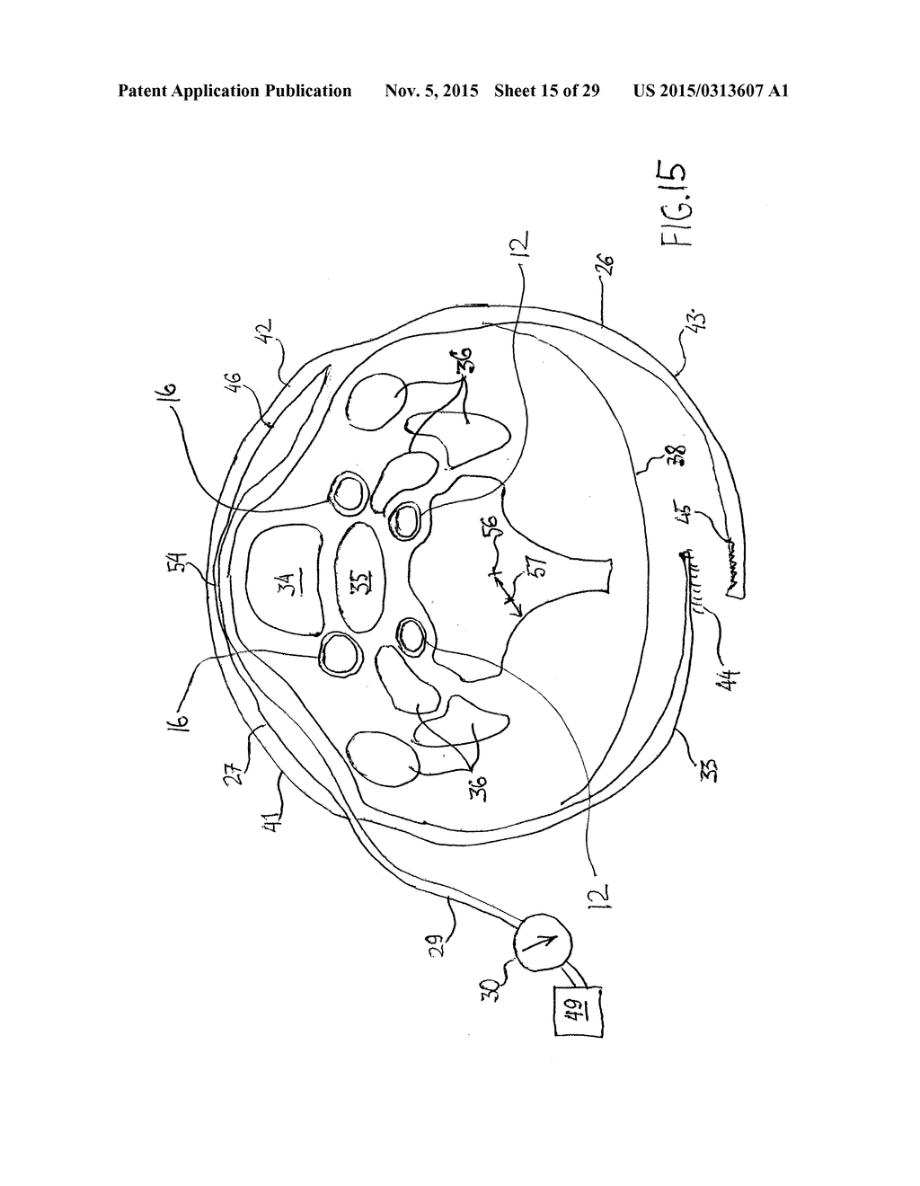 NONINVASIVE PROTECTION FROM EMBOLI - diagram, schematic, and image 16