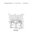 SYSTEM AND METHOD FOR INSERTION OF FLEXIBLE SPINAL STABILIZATION ELEMENT diagram and image