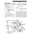 SURGICAL TETHER APPARATUS AND METHODS OF USE diagram and image