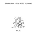 SURGICAL TETHER APPARATUS AND METHODS OF USE diagram and image