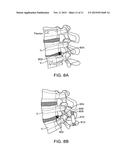 SURGICAL TETHER APPARATUS AND METHODS OF USE diagram and image