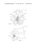INTERSPINOUS IMPLANTS WITH ADJUSTABLE HEIGHT SPACER diagram and image