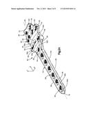 Pancarpal Arthrodesis Bone Plate diagram and image