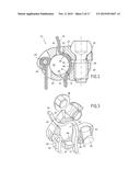 BONE FIXING SYSTEM AND METHOD OF USE diagram and image