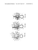 BONE FIXING SYSTEM AND METHOD OF USE diagram and image